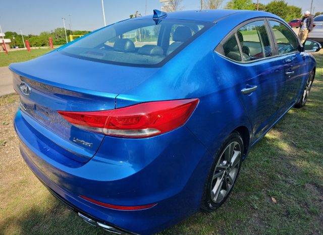 2017 Hyundai Elantra